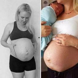 外国产后肚子褶皱视频,外国妈妈的真实挑战与应对之道